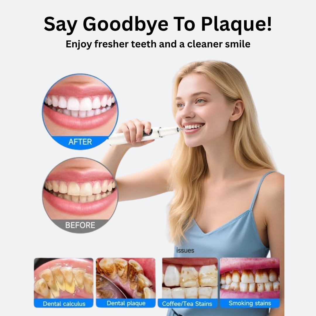 SonicScale Dental Cleaner