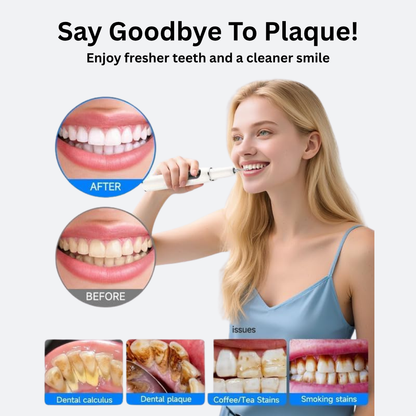 SonicScale Dental Cleaner